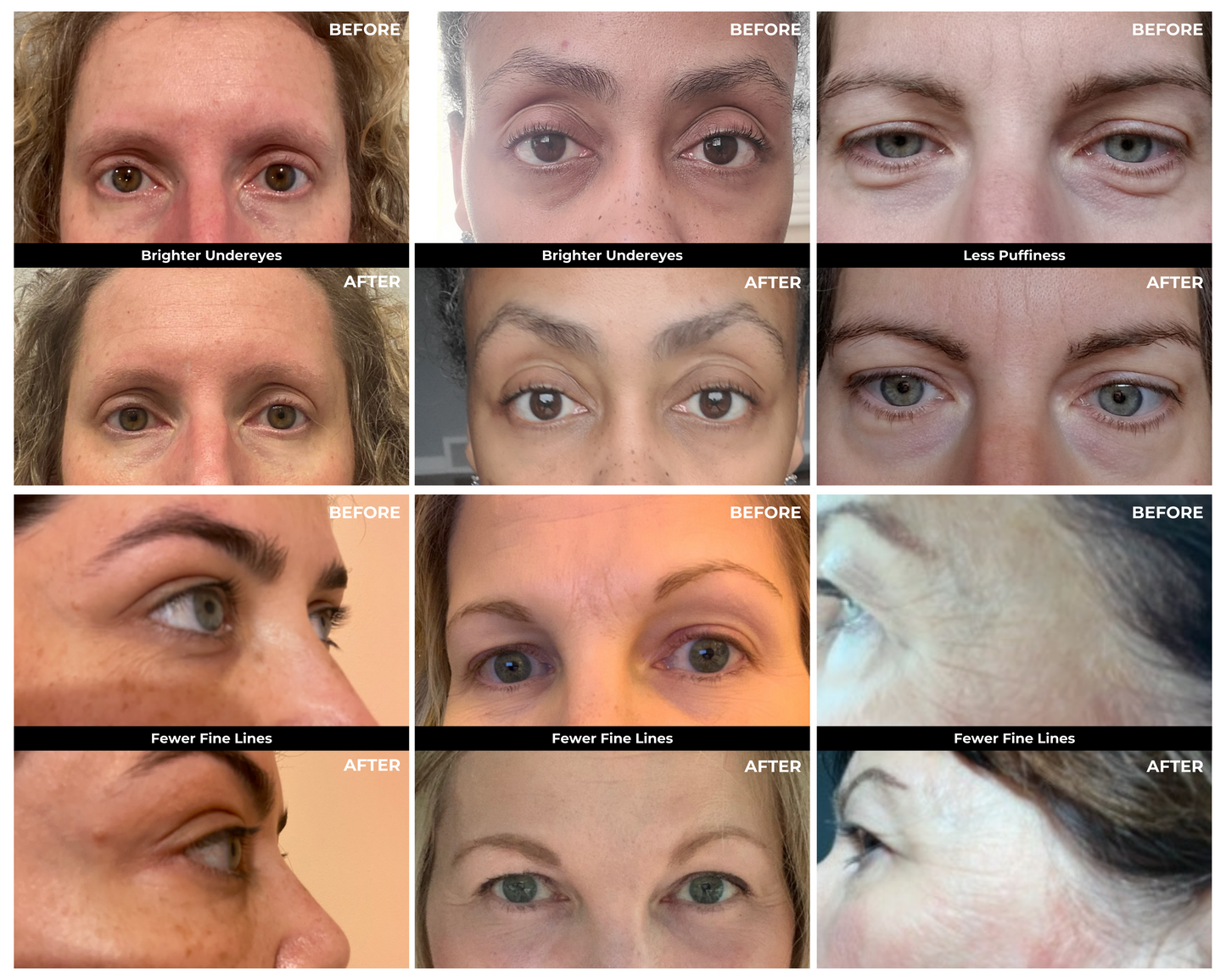 6 sets of before & after pics from eye mask trial participants